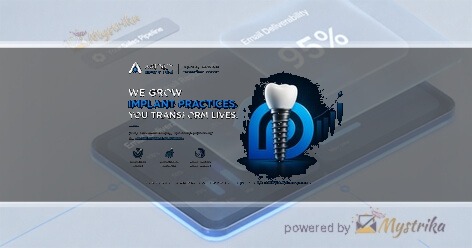 Implant Prospect